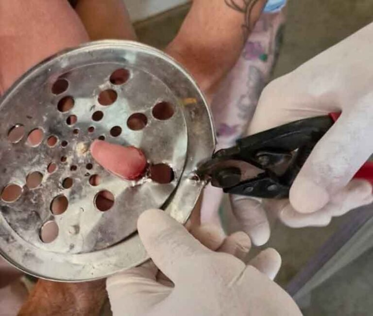 Atenção pais! Criança de 2 anos fica com dedo preso em ralo e é socorrida pelos bombeiros